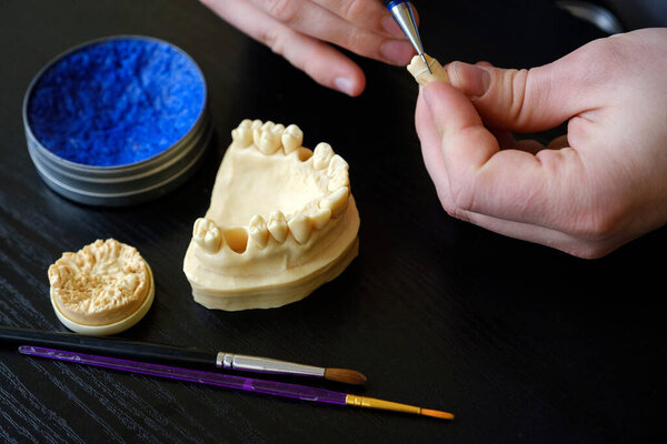 The dental technician is engaged in a modeling of artificial dentures. Quality control of the neck of the tooth.
