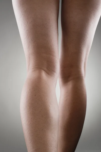 Ból nogi — Zdjęcie stockowe