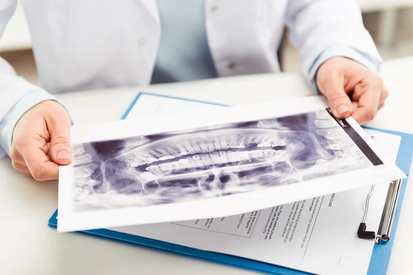 Dentista con radiografia — Foto Stock