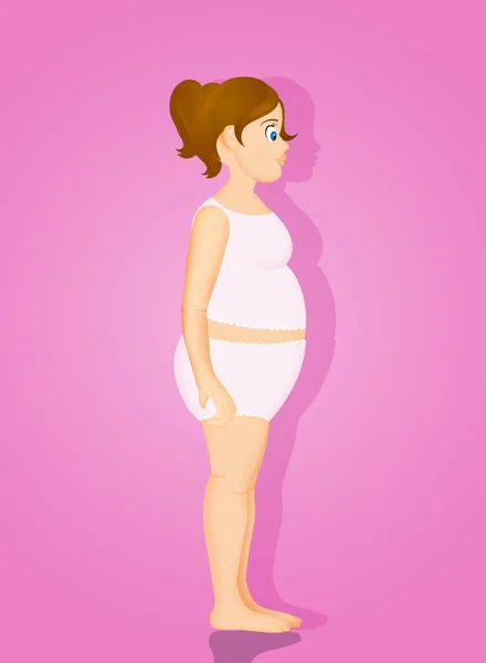 Illustration Overweight Little Girl — Stock Photo, Image