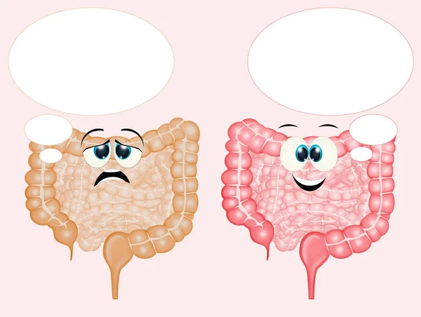 Иллюстрация Больного Кишечника Здорового Кишечника — стоковое фото