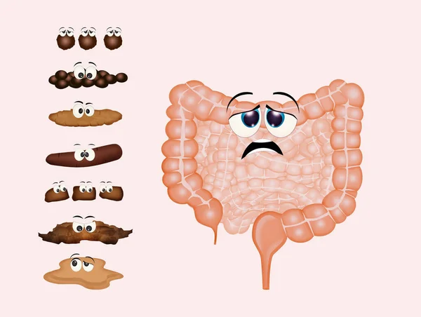 Иллюстрация Больного Кишечника Лицензионные Стоковые Изображения