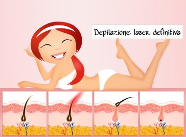 Kalıcı epilasyon
