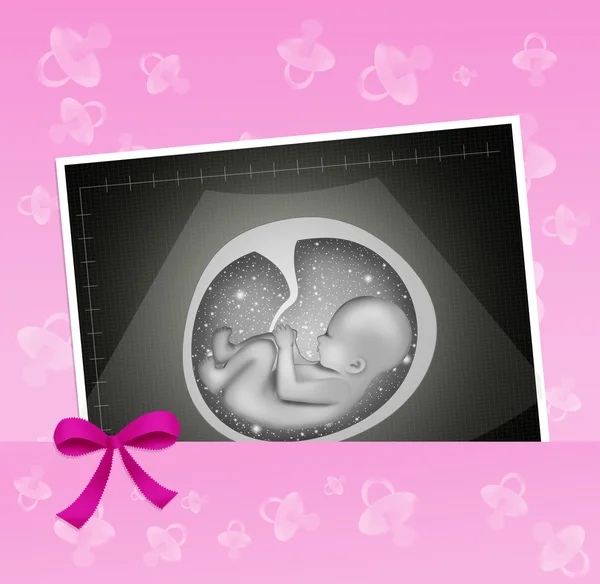 Echography for baby girl — Stock Photo, Image