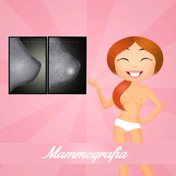 Mammografi — Stok fotoğraf