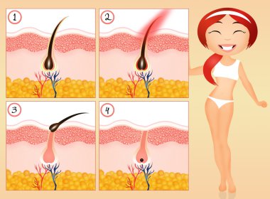 Permanent hair removal clipart