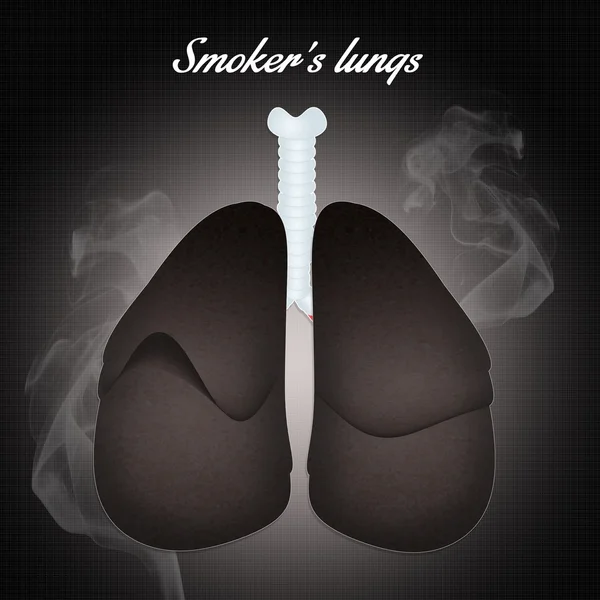 흡연 자의 폐 — 스톡 사진