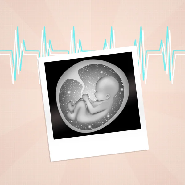 Maternity ultrasound — Stock Photo, Image