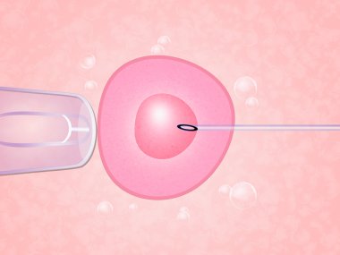 Assisted reproduction clipart
