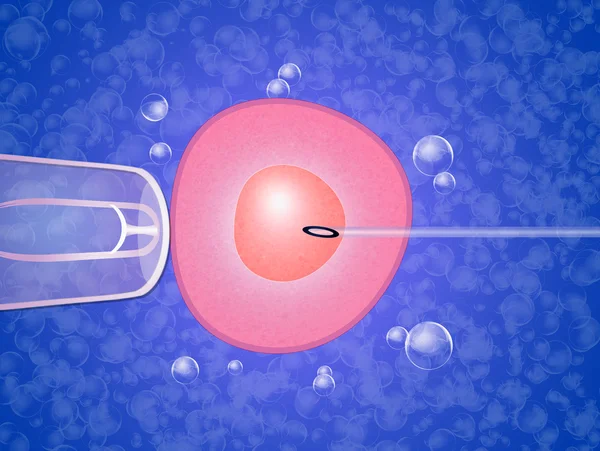 Asszisztált reprodukció — Stock Fotó