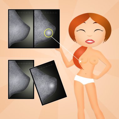 kadın mamografi yapar