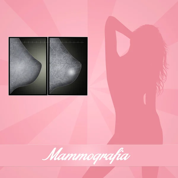 Mammografi — Stok fotoğraf