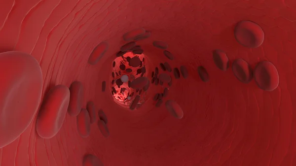 Endothelium. Sel darah merah — Stok Foto