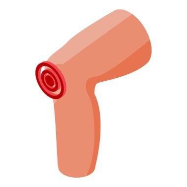 Kireçlenme diz simgesi, izometrik biçim