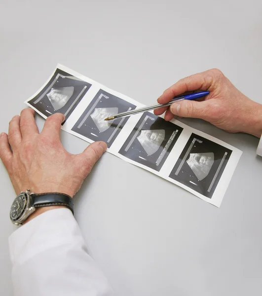 Print on paper of inspection of ultrasonography — Stock Photo, Image