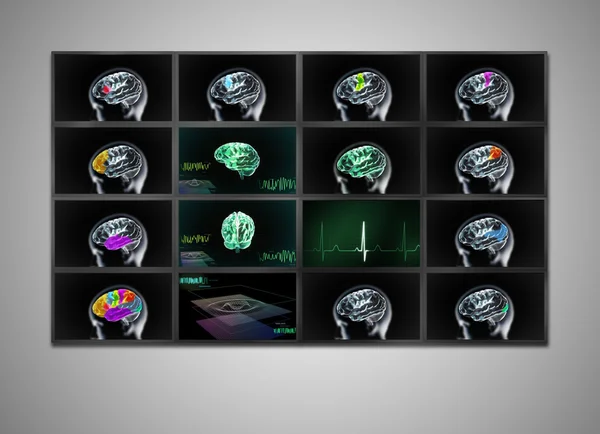 在绿色的医疗监视器显示大脑 — 图库照片