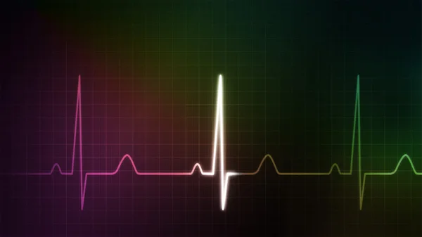 EKG monitor red and green colorful — Stock Photo, Image