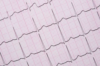 Bir Electrocardiograph olarak da bilinen bir Ekg kapatın