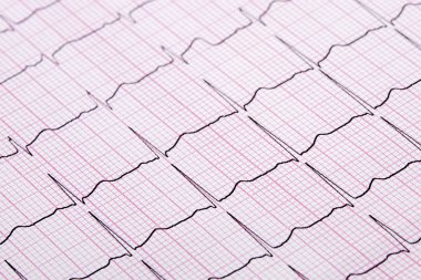 Bir Electrocardiograph olarak da bilinen bir Ekg kapatın