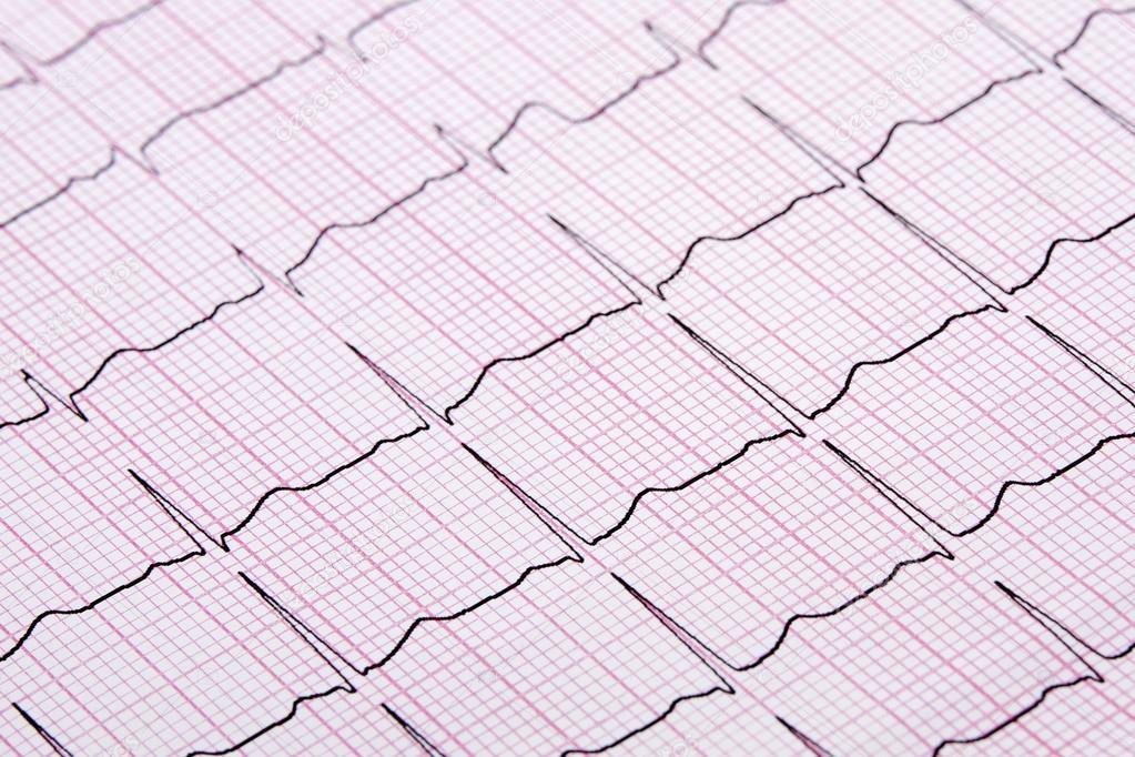 Close up of a Electrocardiograph also known as a EKG