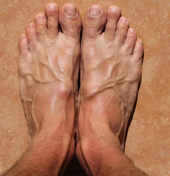 Hallux foot — Stock Photo, Image