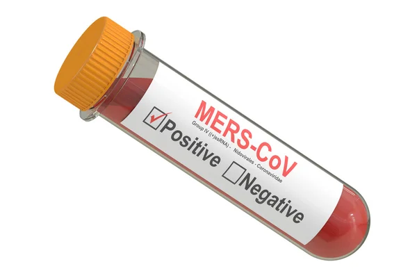 Tubo de teste com amostra de sangue positiva com vírus Mers cov, ren 3D — Fotografia de Stock