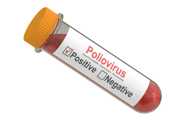 Tubo de ensayo con muestra de sangre poliovirus positivo, renderizado 3D —  Fotos de Stock