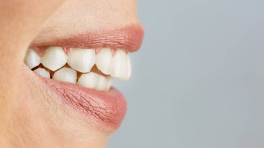 Kadının gülüşü yakın plan, gri arkaplan üzerine kopyalama alanı.