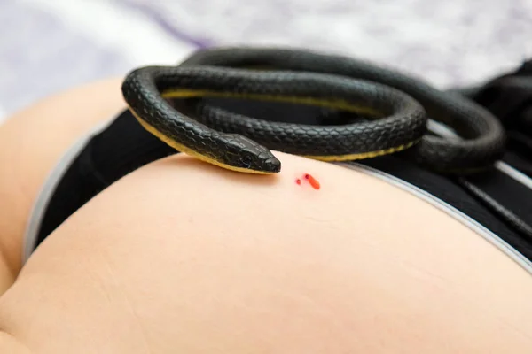 Eine Giftschlange Liegt Auf Dem Körper Einer Gebissenen Frau Ihrer — Stockfoto