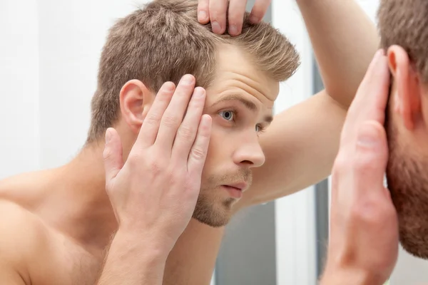 Bonito jovem preocupado com a queda de cabelo — Fotografia de Stock