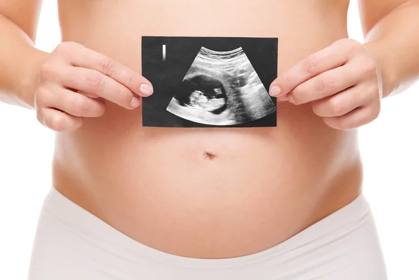 Mujer embarazada sosteniendo un escáner de ultrasonido — Foto de Stock