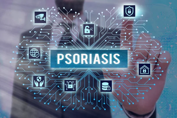 Schrijfbriefje met Psoriasis. Zakelijke foto presentatie chronische huidziekte gekenmerkt door patches met witte schubben Systeembeheerder controle, versnelling configuratie tools concept. — Stockfoto