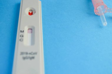 Rapid Diagnostik RDT kasetindeki kan örneği, hızlı kan testi yapan tıbbi teknisyen Coronavirus SARS-CoV-2 COVID-19 antikorlarını tespit etti..