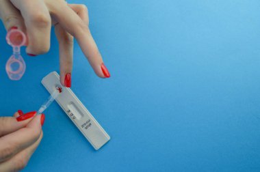 COVID-19 için hızlı test kullanarak pozitif test sonucu, hızlı antikor testi. Antijenlerin COVID-19 hastalığını tespit etmek için laboratuvar antikor testleri yapıyor..