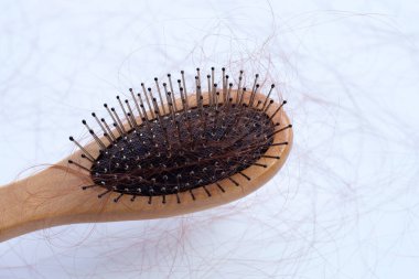 Beyaz arka planda saç dökülmesi.