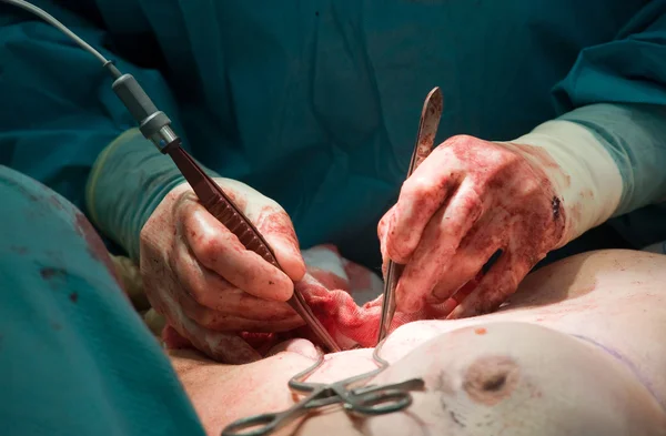 Cirurgião que opera no hospital — Fotografia de Stock