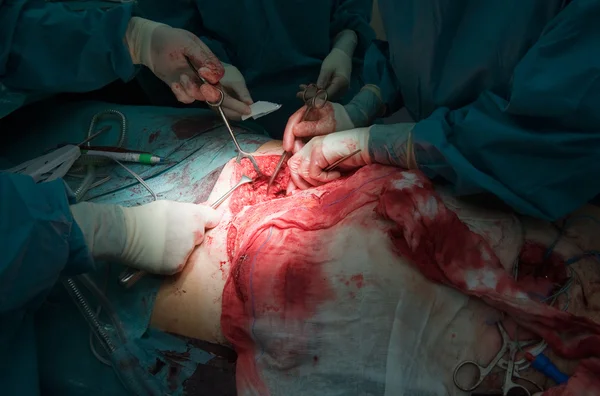 Chirurgiens opérant à l'hôpital — Photo