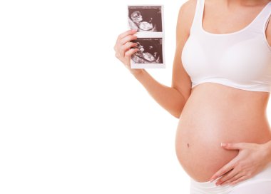 Pretty pregnant woman holding ultrasound scan. Isolated on white background clipart