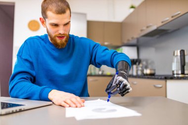 Evde protez el yazısı geliştiren bir adam.