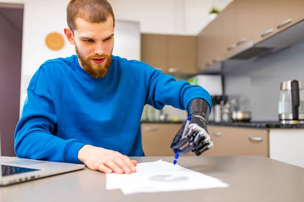 Evde protez el yazısı geliştiren bir adam.