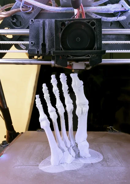 Foot Bones Printing — Stock Photo, Image