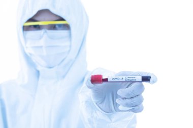 Steriliz laboratuvar önlüğü giyen bilim adamı elinde Covid-19 test tüpü örneği tutuyor. Virüsün adı üzerine seçici odaklanma. Coronavirüs 'ü yenmek için araştırma yapan tıp insanları için konsept.