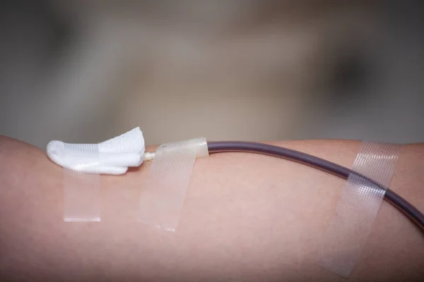 献血活動における針とガーゼの献血者の腕 — ストック写真
