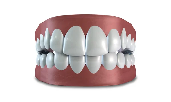Zestaw zębów zamknięte na białym tle — Zdjęcie stockowe