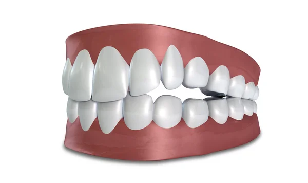 Teeth Set Closed Isolated — Stock Photo, Image