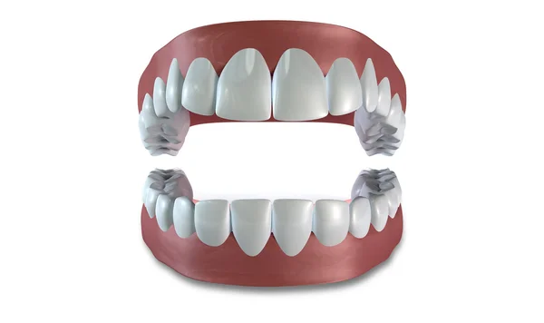 Teeth Set Open Isolated — Stock Photo, Image