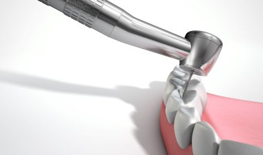 Diş hekimleri matkap ve diş