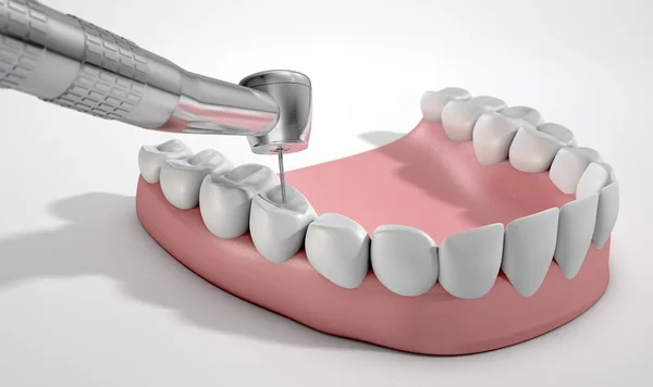 Dentistes Perceuse et dents — Photo