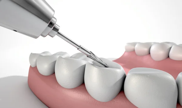 Dentisti trapano e denti — Foto Stock