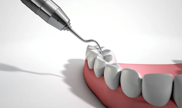 Dentisti sonda gancio e denti — Foto Stock